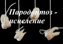 Пародонтоз – уникальный метод исцеления
