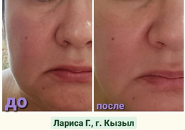 Гидрлизованный морской коллаген